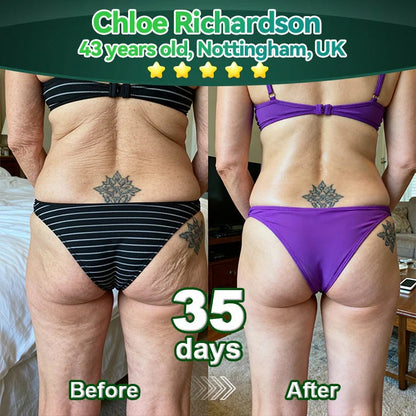 𝑶𝒇𝒇𝒊𝒄𝒊𝒂𝒍 𝑺𝒕𝒐𝒓𝒆 | 𝐌𝐚𝐲𝐨𝐆𝐮𝐨𝐣𝐢® 𝐒𝐭𝐞𝐦 𝐂𝐞𝐥𝐥 & 𝐂𝐨𝐥𝐥𝐚𝐠𝐞𝐧 𝐏𝐞𝐩𝐭𝐢𝐝𝐞 𝐎𝐫𝐚𝐥 𝐒𝐞𝐫𝐮𝐦💧 (Lift & Firm Sagging Skin & Reduce Wrinkle Formation)