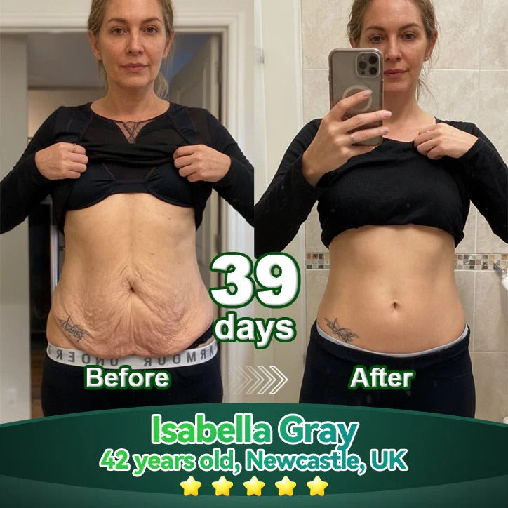 𝑶𝒇𝒇𝒊𝒄𝒊𝒂𝒍 𝑺𝒕𝒐𝒓𝒆 | 𝐌𝐚𝐲𝐨𝐆𝐮𝐨𝐣𝐢® 𝐒𝐭𝐞𝐦 𝐂𝐞𝐥𝐥 & 𝐂𝐨𝐥𝐥𝐚𝐠𝐞𝐧 𝐏𝐞𝐩𝐭𝐢𝐝𝐞 𝐎𝐫𝐚𝐥 𝐒𝐞𝐫𝐮𝐦💧 (Lift & Firm Sagging Skin & Reduce Wrinkle Formation)