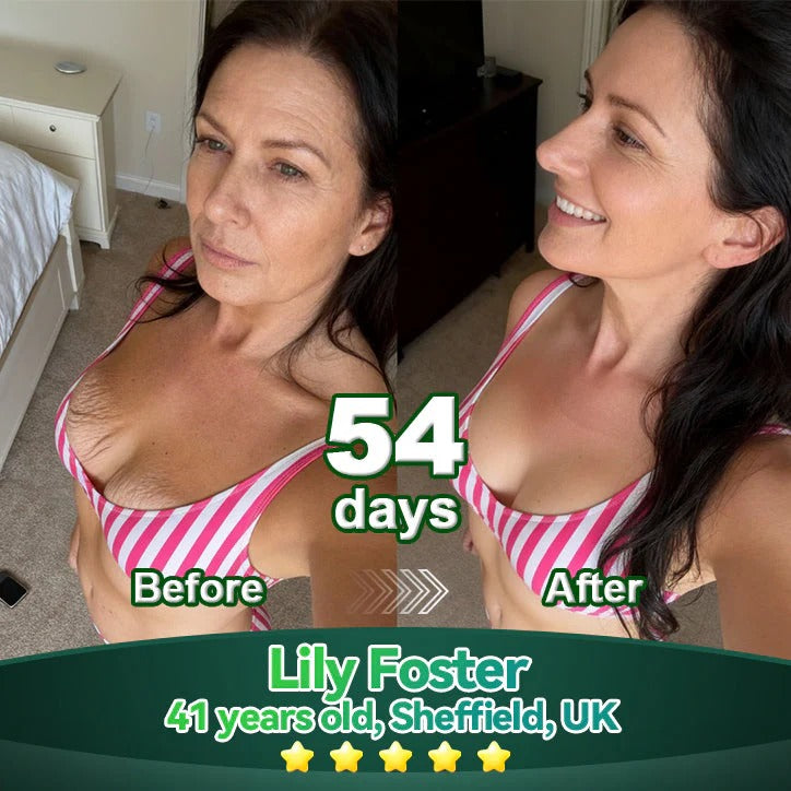 𝑶𝒇𝒇𝒊𝒄𝒊𝒂𝒍 𝑺𝒕𝒐𝒓𝒆 | 𝐌𝐚𝐲𝐨𝐆𝐮𝐨𝐣𝐢® 𝐒𝐭𝐞𝐦 𝐂𝐞𝐥𝐥 & 𝐂𝐨𝐥𝐥𝐚𝐠𝐞𝐧 𝐏𝐞𝐩𝐭𝐢𝐝𝐞 𝐎𝐫𝐚𝐥 𝐒𝐞𝐫𝐮𝐦💧 (Lift & Firm Sagging Skin & Reduce Wrinkle Formation)