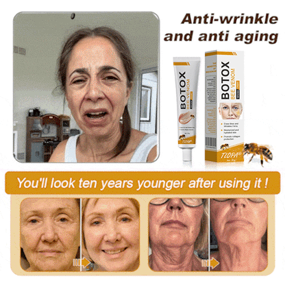Made and dispatched in the UK✨ 𝗧𝗟𝗢𝗣𝗔® Botox Bee Venom Wrinkle Removal Cream👨‍⚕️𝐌𝐇𝐑𝐀 𝐑𝐞𝐜𝐨𝐦𝐦𝐞𝐧𝐝𝐞𝐝✨LAST DAY 80% OFF
