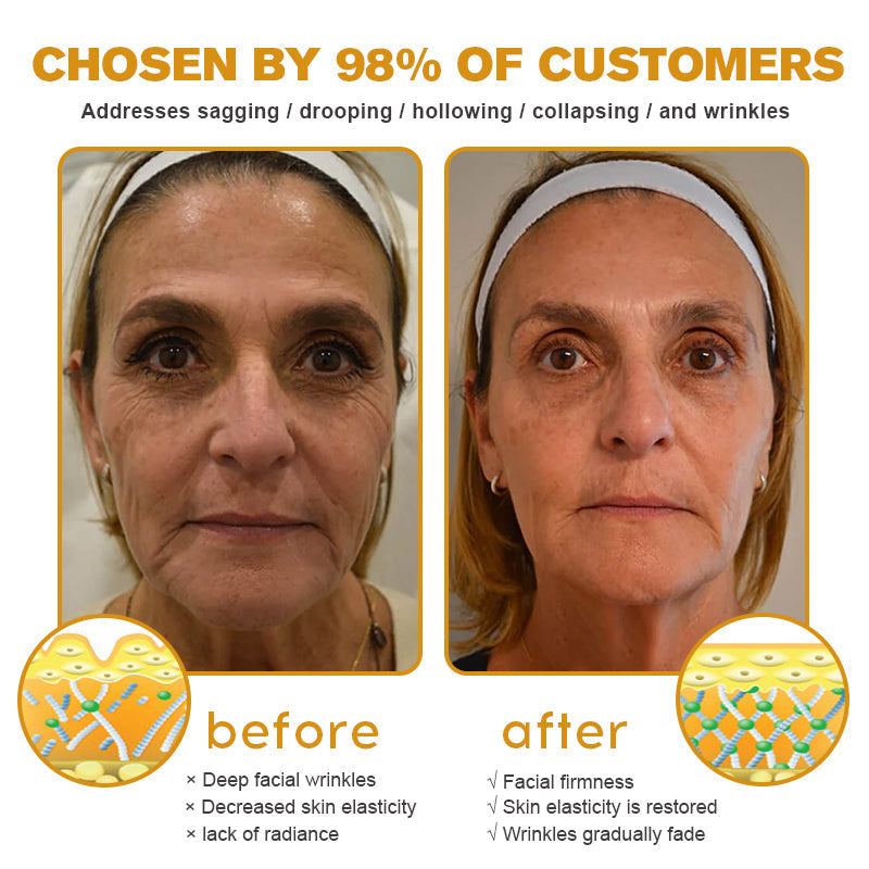 Made and dispatched in the UK✨ 𝗧𝗟𝗢𝗣𝗔® Botox Bee Venom Wrinkle Removal Cream👨‍⚕️𝐌𝐇𝐑𝐀 𝐑𝐞𝐜𝐨𝐦𝐦𝐞𝐧𝐝𝐞𝐝✨LAST DAY 80% OFF