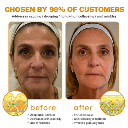 Made and dispatched in the UK✨ 𝗧𝗟𝗢𝗣𝗔® Botox Bee Venom Wrinkle Removal Cream👨‍⚕️𝐌𝐇𝐑𝐀 𝐑𝐞𝐜𝐨𝐦𝐦𝐞𝐧𝐝𝐞𝐝✨LAST DAY 80% OFF
